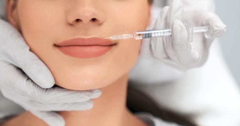 Lip Fillers: What to Expect